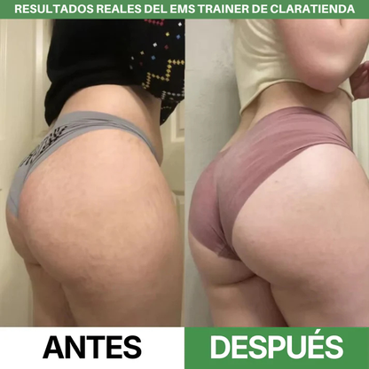 Entrenador EMS – Eleva y Tonifica tus Glúteos